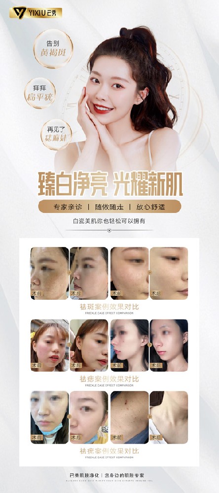 已秀减肥合作收费标准
